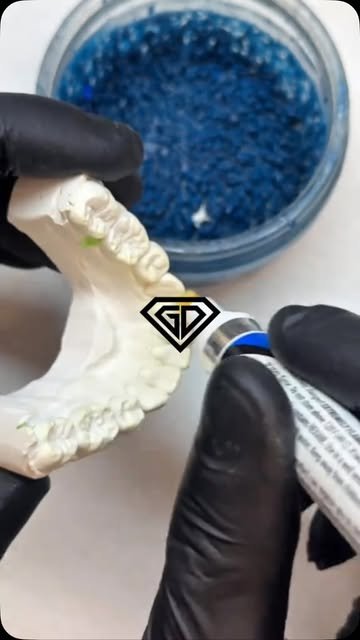 Travail sur un moulage en plâtre de l'empreinte